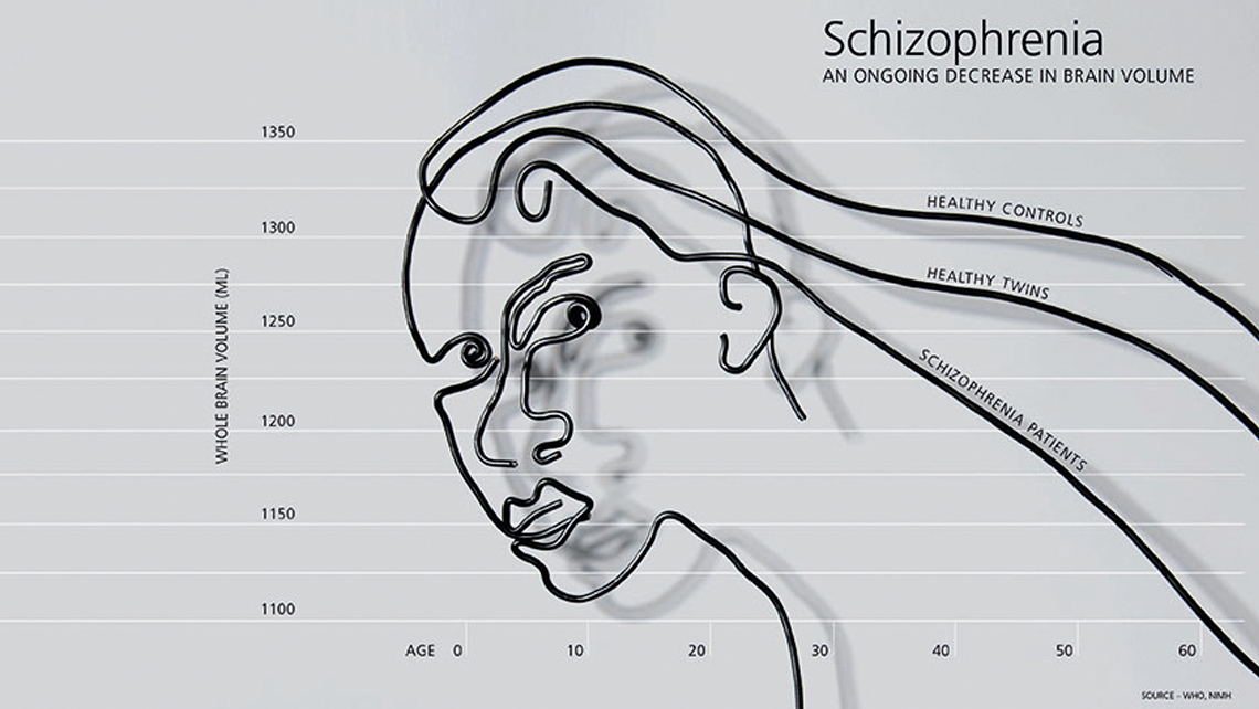 Schizophrenia 