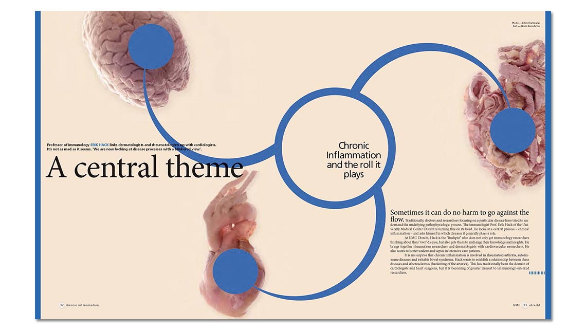 article: chronic inflammation