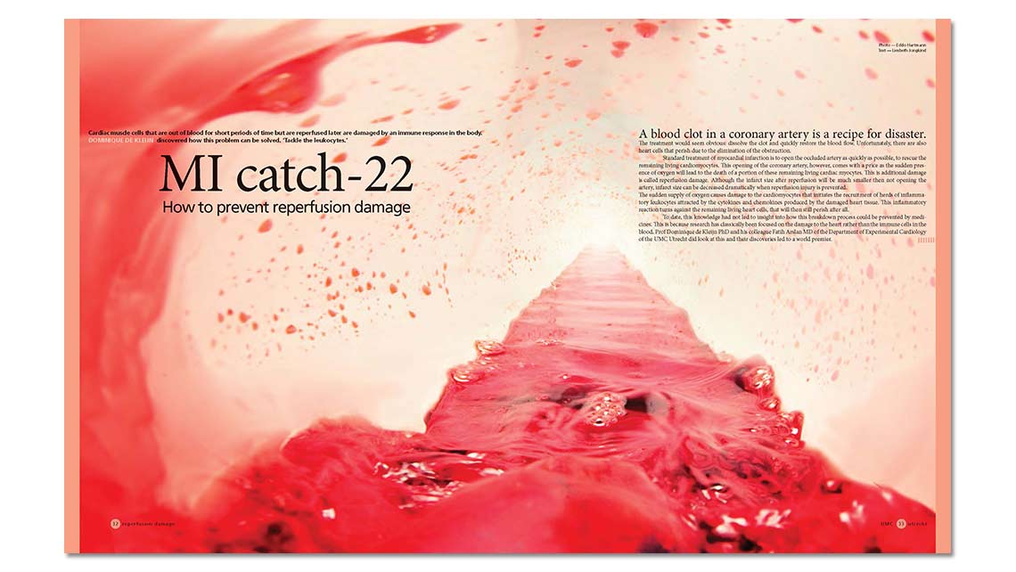 article: blood flow